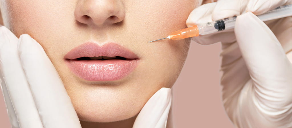 What is a Nasolabial Filler?