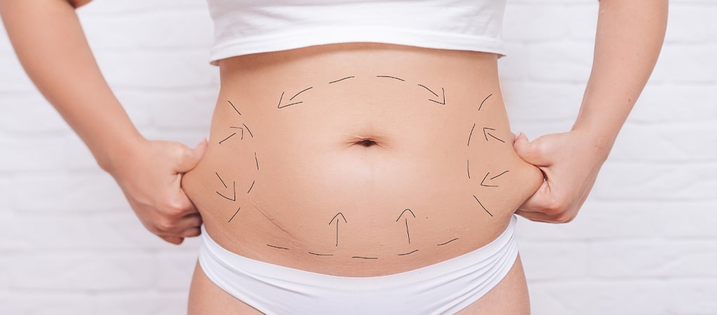 What is a Tummy Tuck